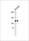R Cask Antibody (Center)